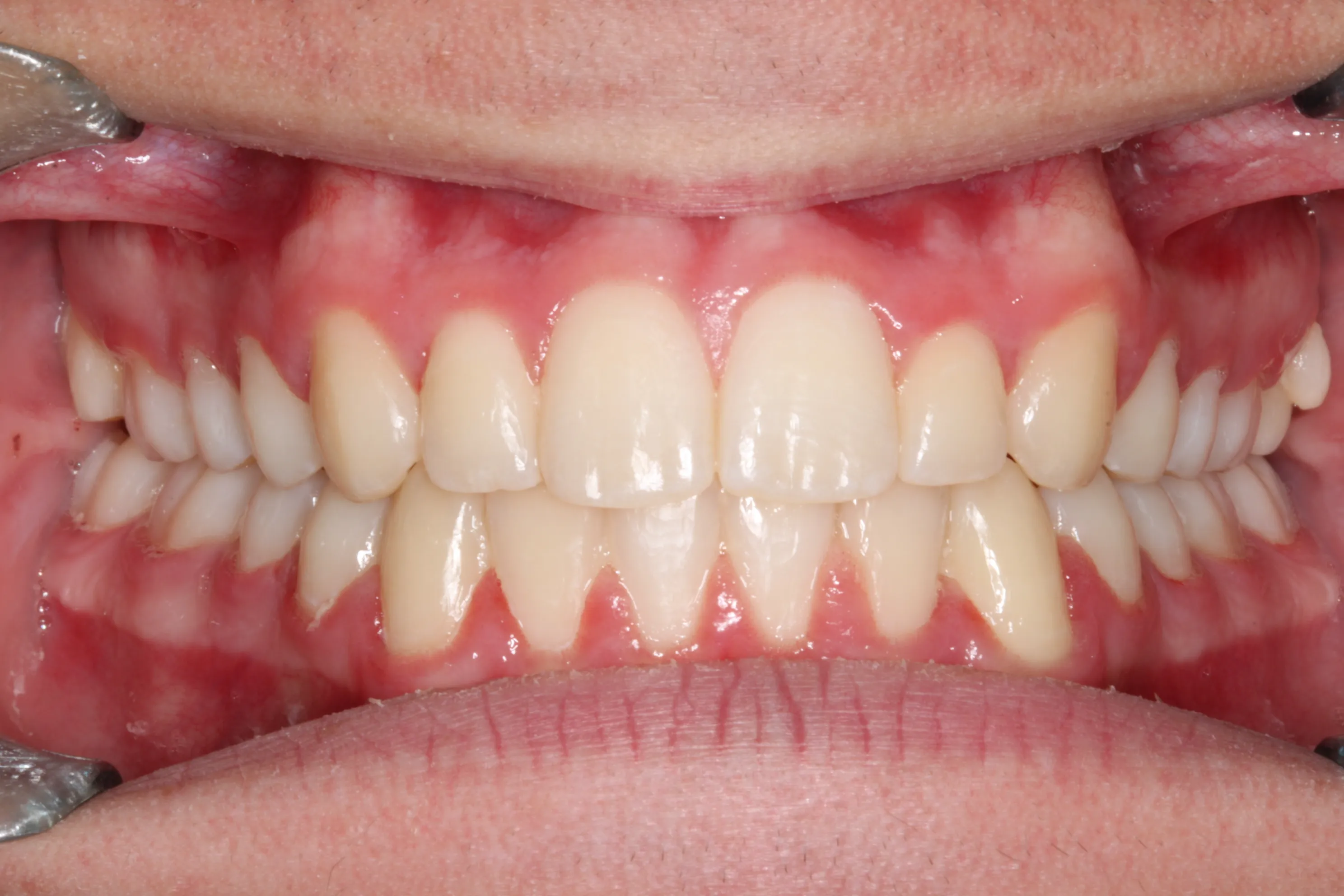 smile-gallery gallery